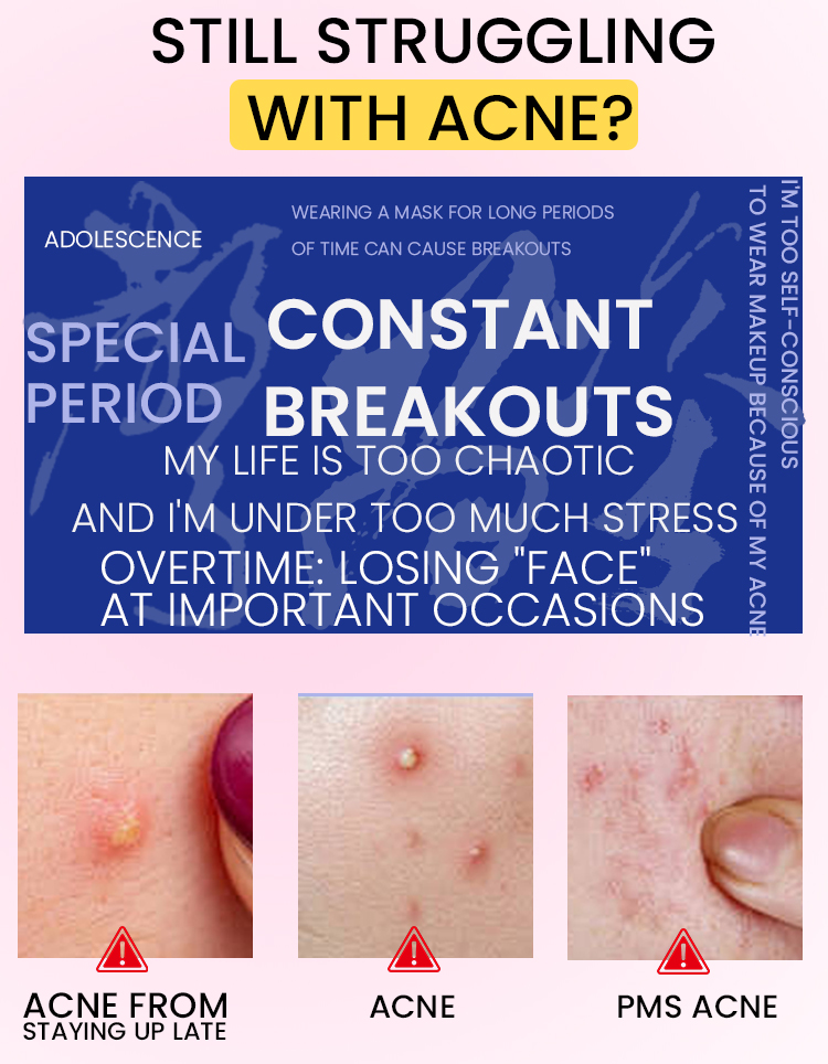 1785200876108459.jpg OEM Hydrocolloid Pimple Patch (2).jpg